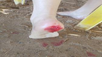 A câmara de vereadores já pediu uma rede de proteção, mas até no momento o executivo não atendeu o pedido.